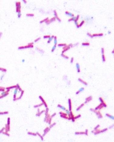 BACILLUS CEREUS. T. ESPOROS.jpg