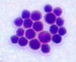 CRYTOCOCCUS NEOFORMANS GRAM.jpg